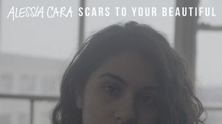 Download Alessia Cara - Scars To Your Beautiful (Official Video) Mp3 (0511 Min) - Free Full Download All Music