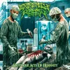 Rotting Placenta