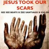 About Jesus Took Our Scars Remix Song