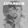 Bruises