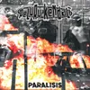 Paralisis