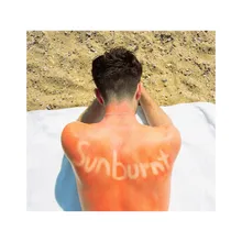 Sunburnt