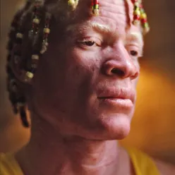 Yellowman