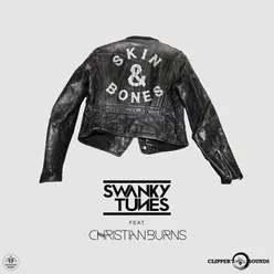 Skin & Bones-Radio Edit