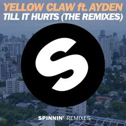 Till It Hurts (feat. Ayden) The Remixes